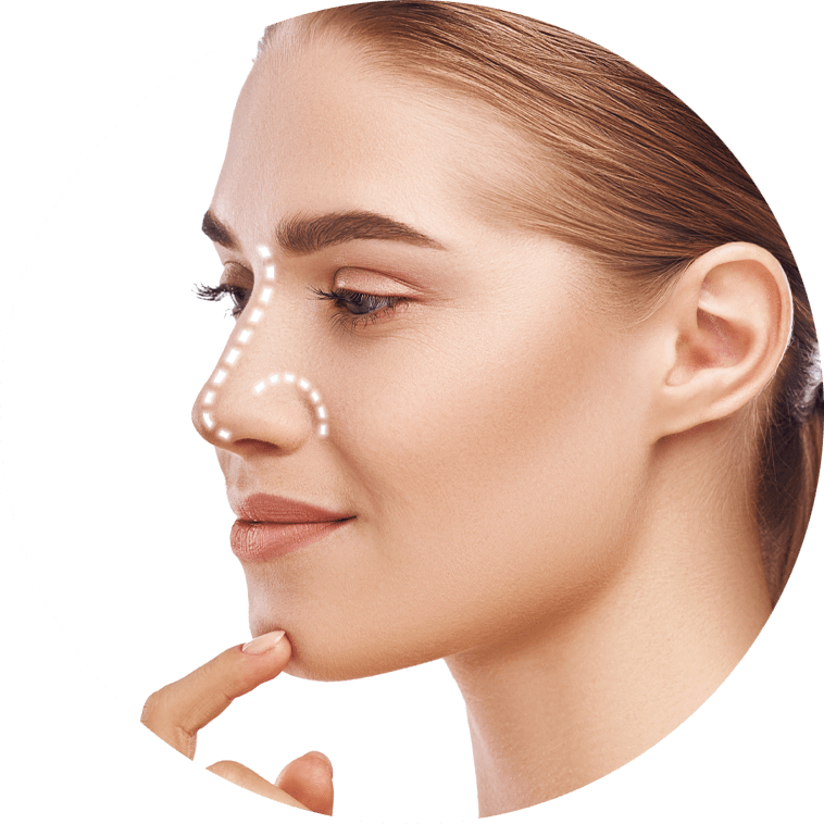 rhinoplasty graphic